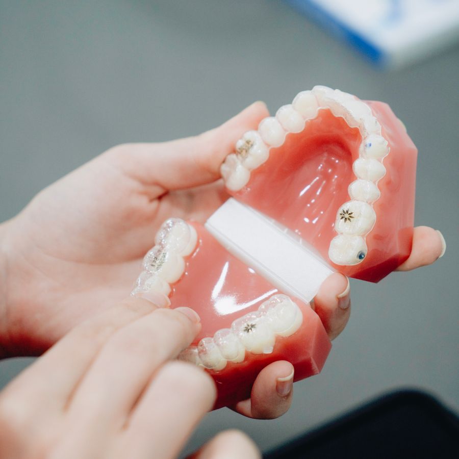 Modelo de prótese dentária